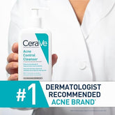 Acne Control Cleanser (237ml) - Cool Craze